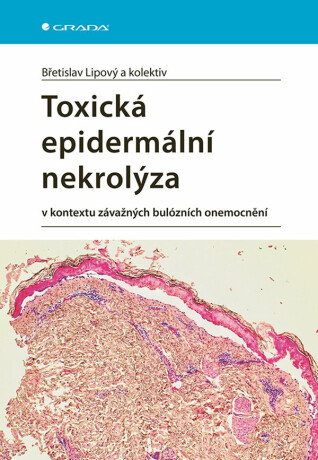 Toxická epidermální nekrolýza - kolektiv autorů,Břetislav Lipový