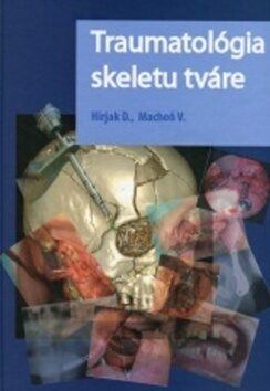 Traumatológia skeletu tváre - Vladimír Machoň,Dušan Hirjak