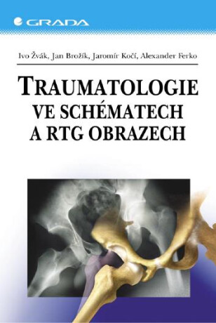Traumatologie ve schématech a RTG obrazech - Ivo Žvák,Ferko Alexander,Jan Brožík,Jaromír Kočí