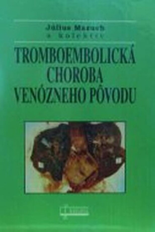 Tromboembolická choroba venózneho pôvodu - Július Mazuch
