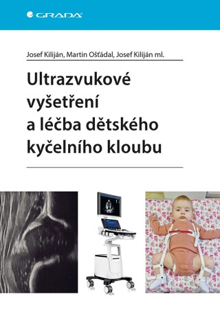 Ultrazvukové vyšetření a léčba dětského kyčelního kloubu - kolektiv autorů,Josef Kiliján,Ošťádal Martin,Josef Kiliján ml.