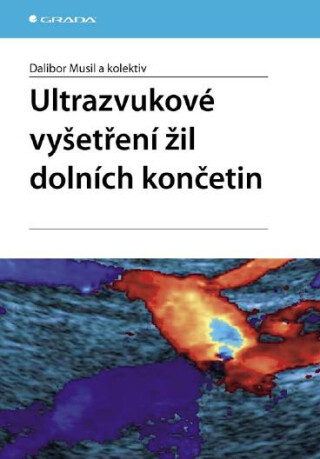 Ultrazvukové vyšetření žil dolních končetin - Dalibor Musil,kolektiv a