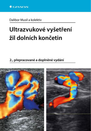 Ultrazvukové vyšetření žil dolních končetin - Dalibor Musil,kolektiv a