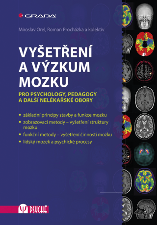 Vyšetření a výzkum mozku - Miroslav Orel,kolektiv a,Roman Procházka