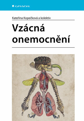 Vzácná onemocnění - Kateřina Kopečková