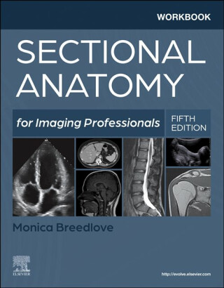 Workbook for Sectional Anatomy for Imaging Professionals - Monica Breedlove