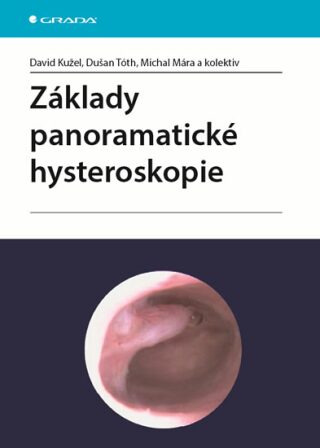 Základy panoramatické hysteroskopie - David Kužel,Tóth Dušan,Michal Mára