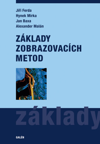 Základy zobrazovacích metod - Jan Baxa,Jiří Ferda,Hynek Mírka,Alexander Malán