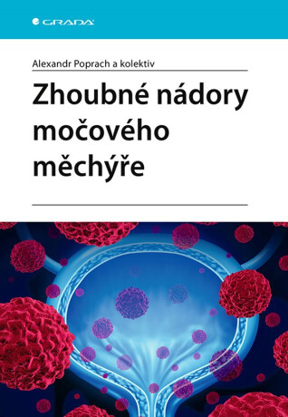 Zhoubné nádory močového měchýře - kolektiv a,Alexandr Poprach