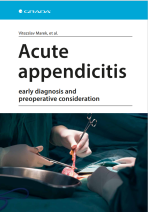 Acute appendicitis - 