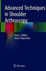 Advanced Techniques in Shoulder Arthroscopy - Millett Peter J.