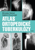Atlas ortopedické tuberkulózy - Dalimil Chocholáč, ...