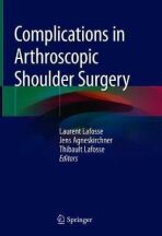 Complications in Arthroscopic Shoulder Surgery - Lafosse Laurent