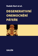 Degenerativní onemocnění páteře -  et al.,Radek Hart