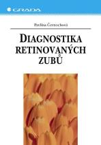 Diagnostika retinovaných zubů - Pavlína Černochová