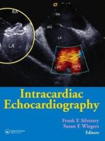 Intracardiac Echocardiography - Silvestry Frank E.