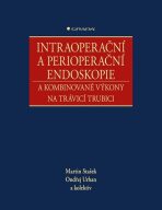Intraoperační a perioperační endoskopie a kombinované výkony na trávicí trubici - Ondřej Urban,Stašek Martin