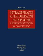 Intraoperační a perioperační endoskopie a kombinované výkony na trávicí trubici - kolektiv a, Ondřej Urban, ...