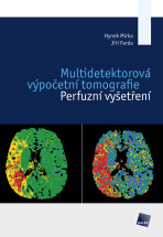 Multidetektorová výpočetní tomografie - Jiří Ferda,Hynek Mírka