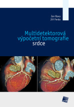Multidetektorová výpočetní tomografie srdce - Jan Baxa,Jiří Ferda