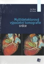 Multidetektorová výpočetní tomografie srdce - Jiří Ferda,Jan Baxa