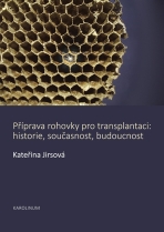 Příprava rohovky pro transplantaci - Kateřina Jirsová