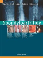Spondyloartritidy - Karel Pavelka, ...