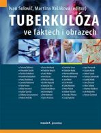 Tuberkulóza ve faktech i obrazech - Martina Vašáková, ...