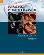 Ultrazvuk prvního trimestru - Ladislav Krofta