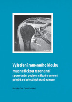 Vyšetření ramenního kloubu magnetickou rezonancí s podrobným popisem nálezů u omezení pohybů u bolestivých stavů ramene - Boris Pauček,David Smékal