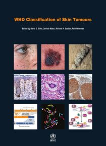 WHO classification of skin tumours - 