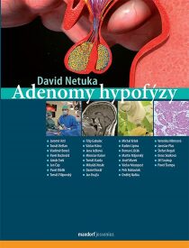 Adenomy hypofýzy - Netuka David