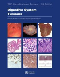 Digestive system tumours - World Health Organization