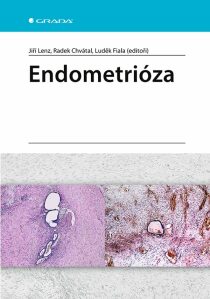 Endometrióza - Luděk Fiala, Jiří Lenz, ...