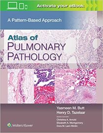 Atlas of Pulmonary Pathology : A Pattern Based Approach - Butt Yasmeen Mahmood