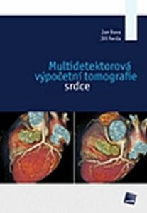 Multidetektorová výpočetní tomografie srdce - Jiří Ferda,Jan Baxa