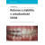 Retence a stabilita v ortodontické léčbě